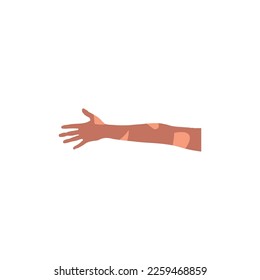 Leprosy icon. Simple style leprosy day poster background symbol. Leprosy brand logo design element. Leprosy t-shirt printing. vector for sticker.