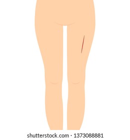 lesion on leg vector. wallpaper. free space for text. copy space. suture.