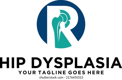 Letter R Hip Dysplasia Logo Design