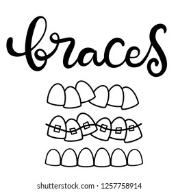 Lettering illustration about dental healthcare with the image of braces on teeth. EPS10. 
Vector image of the stages of orthodontic treatment for posters for dental clinic.