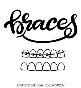 Lettering illustration about dental healthcare with the image of braces on teeth. EPS10. 
Vector image of the stages of orthodontic treatment for posters for dental clinic.