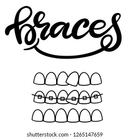 Lettering illustration about dental healthcare with the image of braces on teeth. EPS10. 
Vector image of the stages of orthodontic treatment for posters for dental clinic.