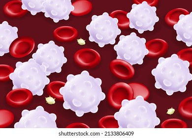 Leukemia. Red Blood Cells, White Blood Cells And Platelets.