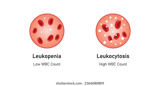 Diseño conceptual de leucopenia y leucocitosis. Ilustración vectorial.
