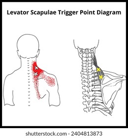 Levator Scapulae Trigger Point Diagram, Trigger Point Diagrams	
