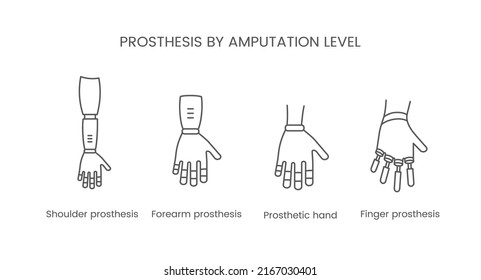 Level Amputation Arm Prosthetic Vector Line Stock Vector (Royalty Free ...