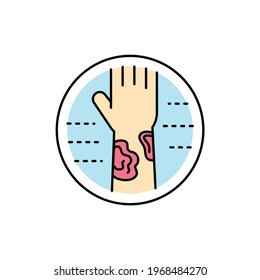 Lichen planus color line icon. Dermatology disease. Isolated vector element. Outline pictogram for web page, mobile app, promo