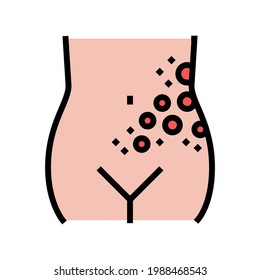 lichen shingles disease color icon vector. lichen shingles disease sign. isolated symbol illustration