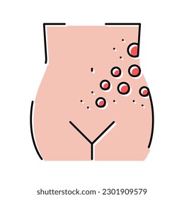 lichen shingles disease color icon vector. lichen shingles disease sign. isolated symbol illustration