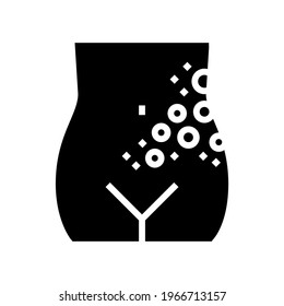 lichen shingles disease glyph icon vector. lichen shingles disease sign. isolated contour symbol black illustration