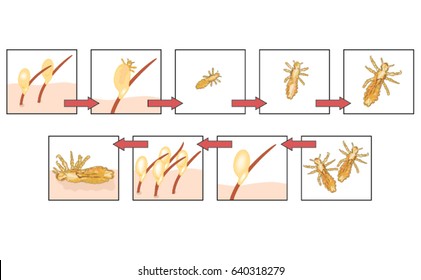 The life cycle of headlice showing eggs on hair shaft, hatching, moulting, mating and death of lice in human hair.