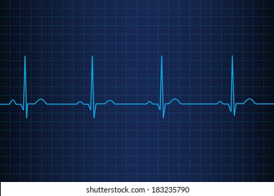 Lifeline in an electrocardiogram