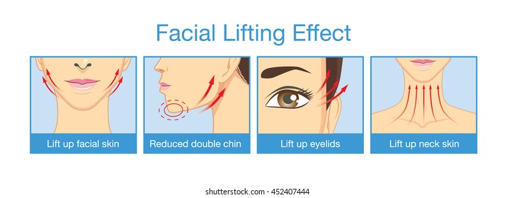 Lifting effect on facial of women when get rid face fat. Reduce double chin. Lifting eyelid and neck skin.