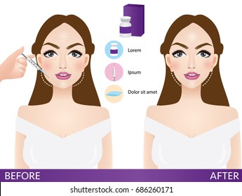 lifting and wrinkle injection surgery vector illustration