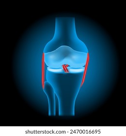 lesiones de ligamentos en la rodilla. Articulación de rodilla humana transparente realista con efecto brillante sobre fondo oscuro. Ilustración vectorial como la Imagen de rayos X para el diseño sanitario. Traumatismo de rodilla