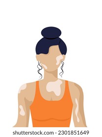 light-skinned faceless girl with vitiligo on white background. vector illustration. beauty of a different kind. body positive.