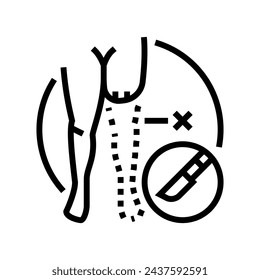 limb amputation surgery line icon vector. limb amputation surgery sign. isolated contour symbol black illustration