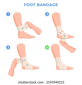 Limb Bandaging Stepbystep Instructions Help Leg Stock Vector (Royalty ...