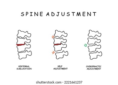 Line Art der chiropraktischen Wirbelsäulenanpassung. Rückenverletzungen und neuronale Verbindungen. Gehirn- und Rückenmark-Physiologie und Anatomie. Verbindung.