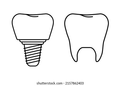 Line art Tooth and dental implant for stomatology or dentistry template. Icon design. Isolated vector illustration