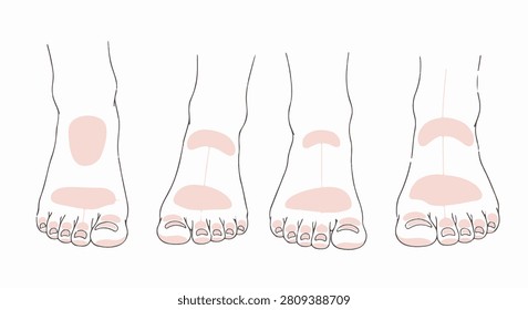 Line art vector illustration of four female foot variations showcasing different toe shapes and lengths including Egyptian, Roman, and Greek foot types with pink anatomical highlights.