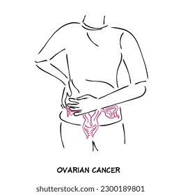 line art vector of ovarian cancer artwork. ovarian cancer clipart