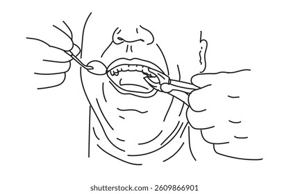 line drawing of  dentist examining patient teeth condition and doing tooth filling. Medical health care service workers concept one line draw design vector eps