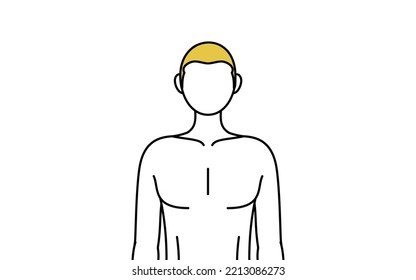 Line drawing of a man who has had his hair removed, pose standing facing forward