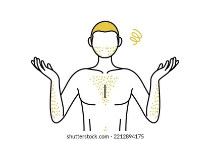 Line drawings of men suffering from thick body hair, pose with arms outstretched in distress