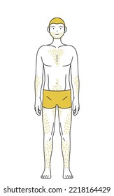 Line drawings of men suffering from thick body hair, pose standing facing forward