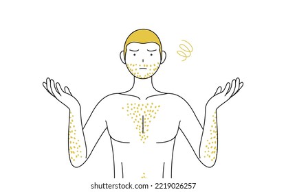 Line drawings of men suffering from thick body hair, pose with arms outstretched in distress