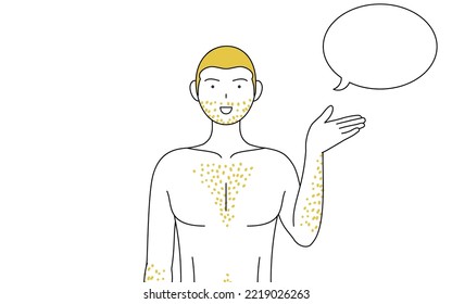 Line drawings of men suffering from thick body hair, speaking pose with palms facing each other