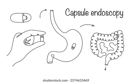 Line drawn capsule endoscopy procedure. A swallowable capsule with a camera for examining the gastrointestinal tract. Medical vector. Capsule endoscopy.