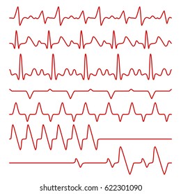 Line vector cardiograms or electrocardiogram on monitor, heartbeat medical symbols