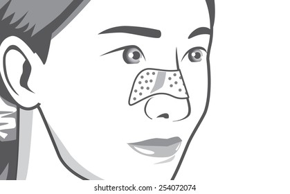 Linear of closeup shot acne pads on women nose