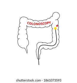 linear colonoscopy procedure sign. hardware examination of large bowel, rectum. medicine concept, element of anatomy, healthcare for science apps, information graphic poster. isolated object on white