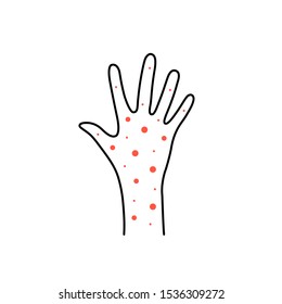 linear hand with rash or psoriasis. flat stroke style trend modern dry skin logotype graphic design isolated on white. concept of medical issue in man or woman or treatment atopic dermatitis