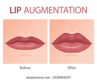 Lippenvergrößerungsdiagramm auf weißem Hintergrund. 