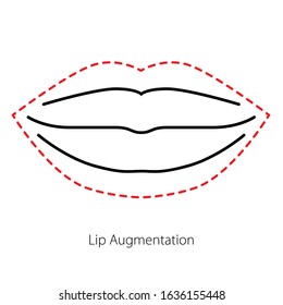 Lip augmentation. Vector isolated icon with lip before and after. Medicine, injection, cosmetology. Sign with dashed line for web design and social media