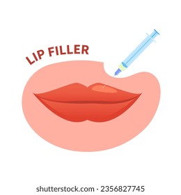 Lip dermal filler plumping injection for volume enhancement. Mouth cosmetic treatment of contouring and reshaping correction. Rejuvenation beauty concept. Flat vector illustration isolated on white.