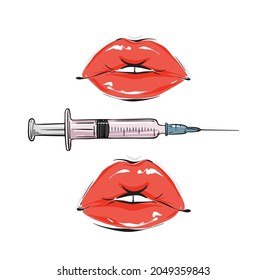  Lip filler procedure Beauty injection vector illustration Glamour fashion  art facial medical surgery treatment  vector