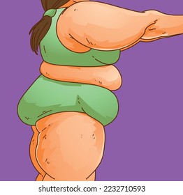 Lipedema. Women's body with health problems. Healthcare illustration, medical infographics. Vector illustration. svg