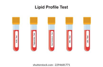 Design des Lipid-Profils Testkonzepts. Vektorgrafik.