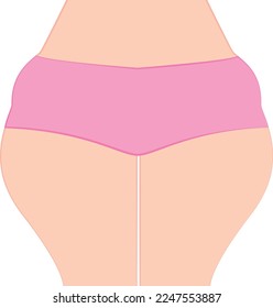 Lipoedema Female Thighs. Lipoedema Fat Body of a Woman. Cosmetic Surgery, Liposuction Ad. Vector Illustration