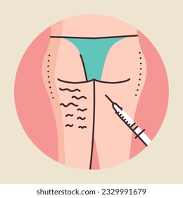 Lípoliticos en la ilustración de la línea de color de las nalgas. Concepto de cuidado de la piel de cosmetología. 