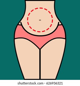 Liposuction of abdomen. Close up vector illustration of body contour with dotted line. Plastic surgery. Getting rid of excess fat.