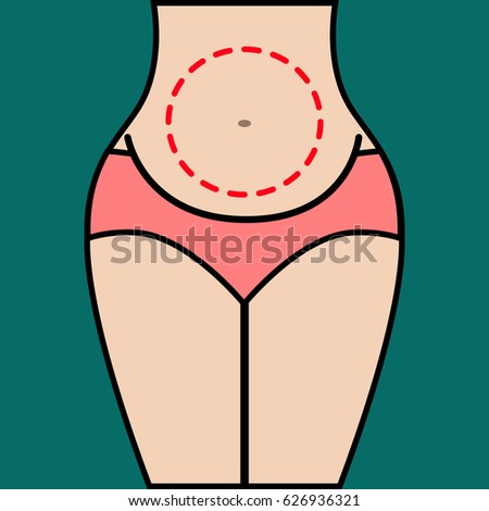 Liposuction of abdomen. Close up vector illustration of body contour with dotted line. Plastic surgery. Getting rid of excess fat.