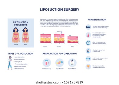 Liposuction and body plastic surgery procedure and rehabilitation - educational medical banner template with flat cartoon characters and text, vector illustration.