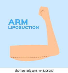 liposuction body set . vector