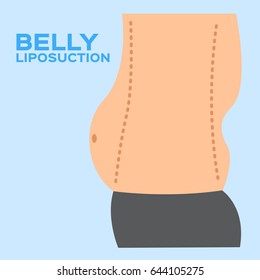 liposuction body set . vector